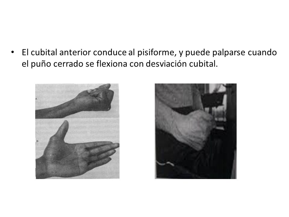 El cubital anterior conduce al pisiforme, y puede palparse cuando el puño cerrado se flexiona con desviación cubital.