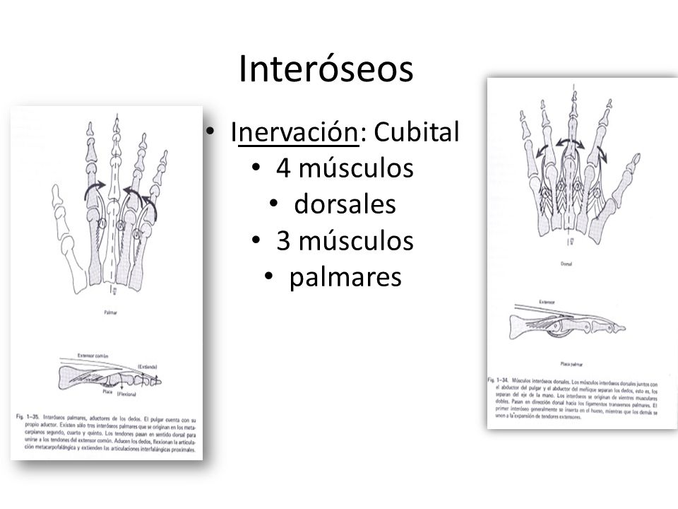 Interóseos Inervación: Cubital 4 músculos dorsales 3 músculos palmares