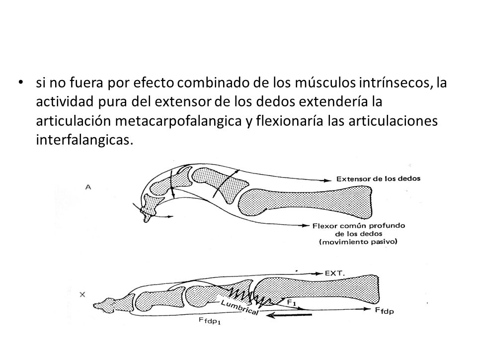 si no fuera por efecto combinado de los músculos intrínsecos, la actividad pura del extensor de los dedos extendería la articulación metacarpofalangica y flexionaría las articulaciones interfalangicas.