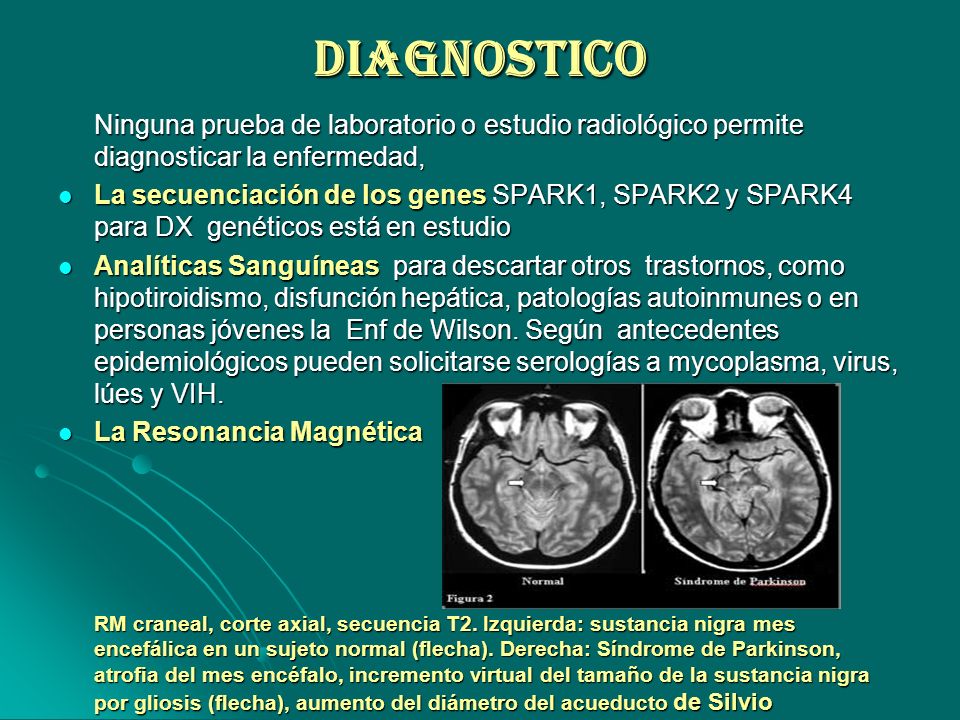 DIAGNOSTICO Ninguna prueba de laboratorio o estudio radiológico permite diagnosticar la enfermedad,