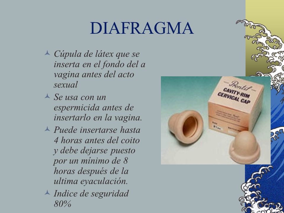 DIAFRAGMA Cúpula de látex que se inserta en el fondo del a vagina antes del acto sexual. Se usa con un espermicida antes de insertarlo en la vagina.