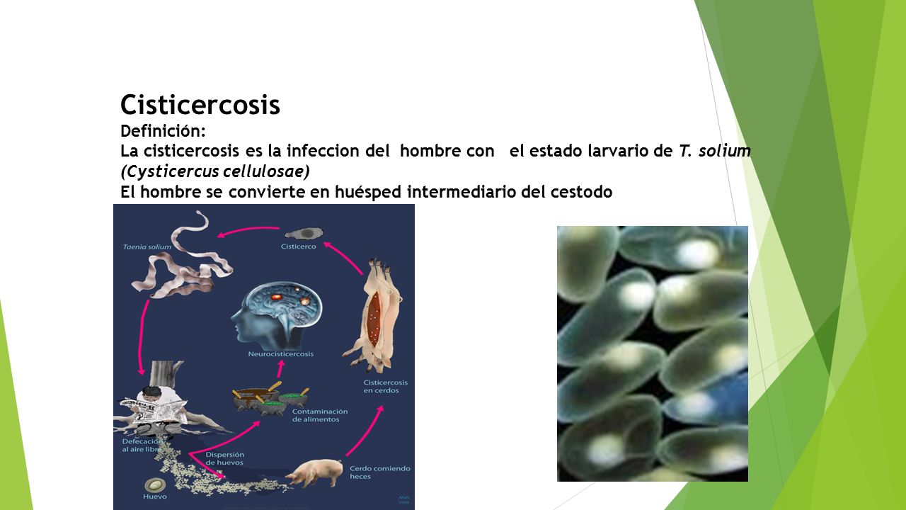 Cisticercosis Definición: La cisticercosis es la infeccion del hombre con el estado larvario de T.