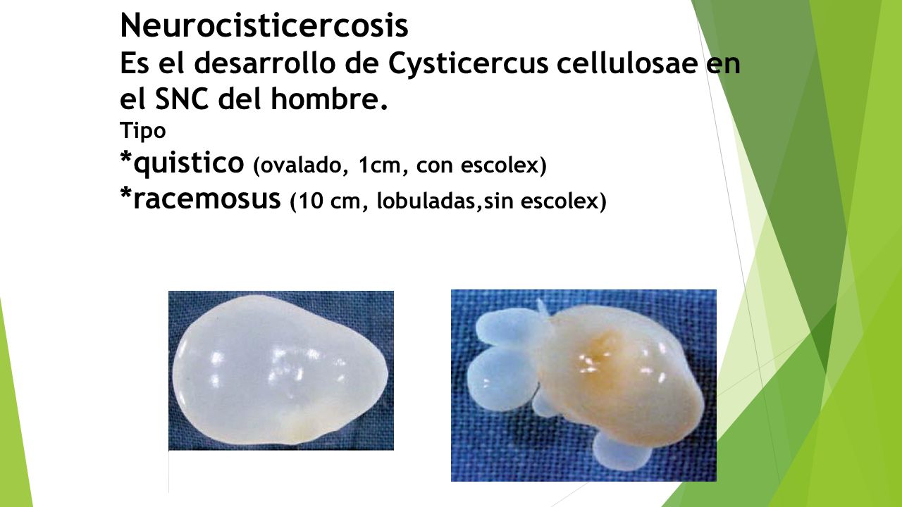 Neurocisticercosis Es el desarrollo de Cysticercus cellulosae en el SNC del hombre.