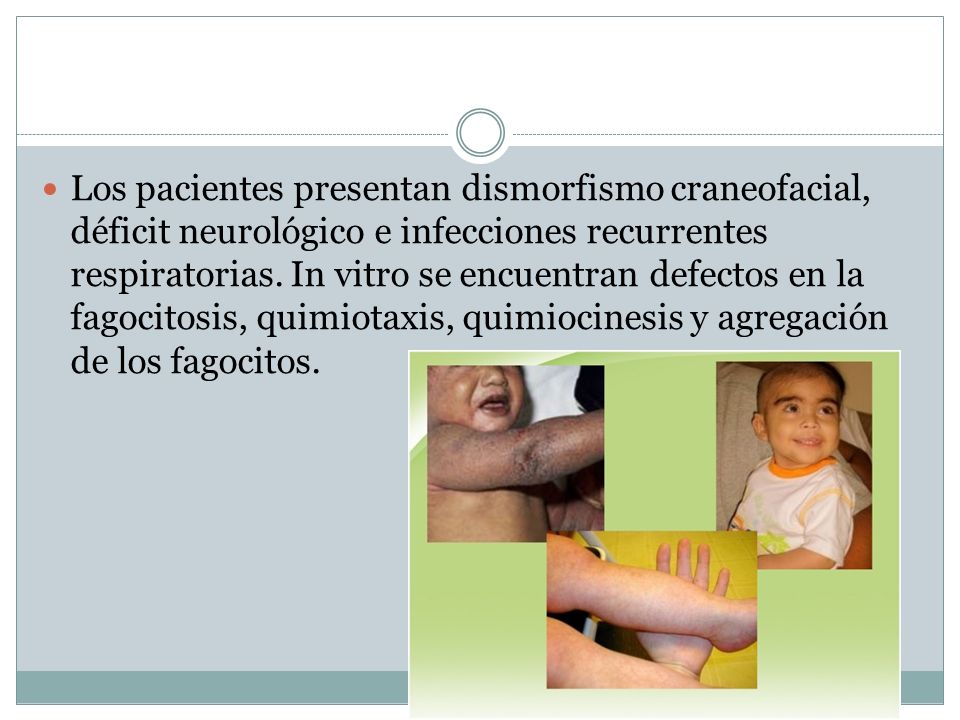 Los pacientes presentan dismorfismo craneofacial, déficit neurológico e infecciones recurrentes respiratorias.