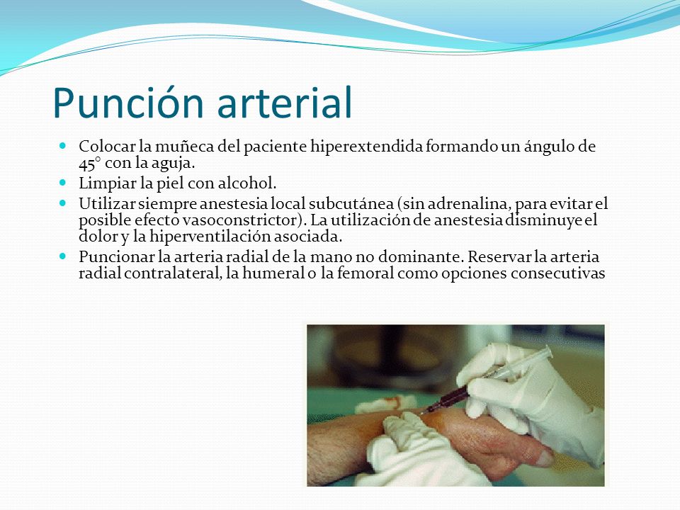 Punción arterial Colocar la muñeca del paciente hiperextendida formando un ángulo de 45° con la aguja.