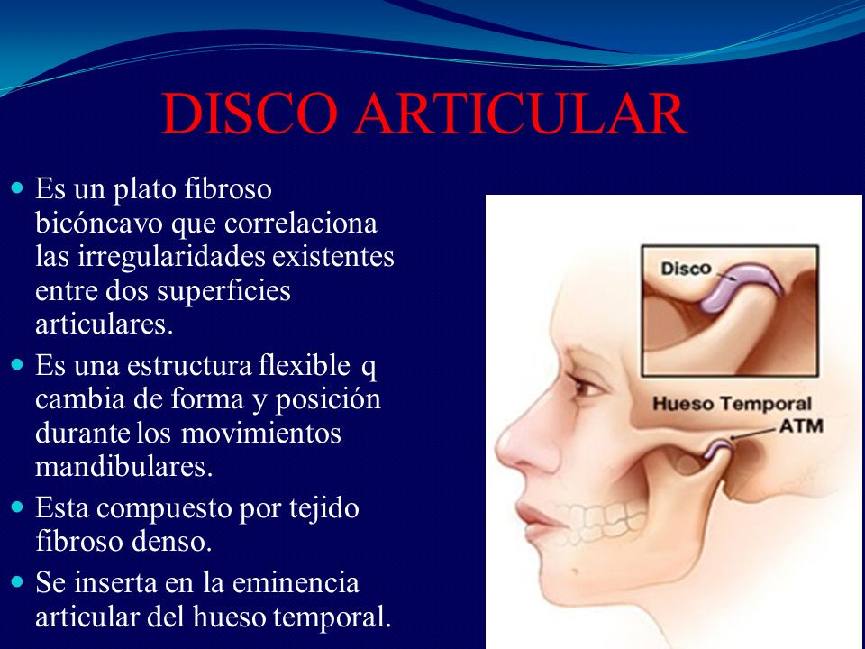 DISCO ARTICULAR Es un plato fibroso bicóncavo que correlaciona las irregularidades existentes entre dos superficies articulares.