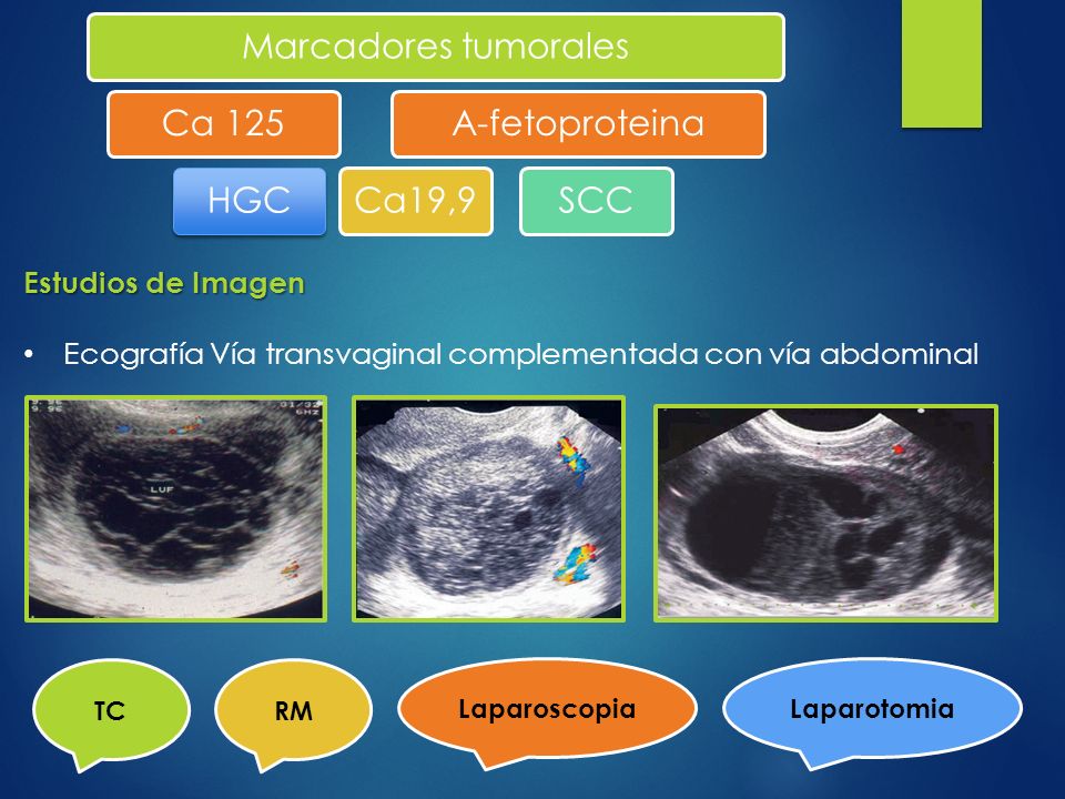 Marcadores tumorales Ca 125 HGC Ca19,9 A-fetoproteina SCC
