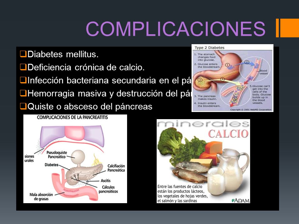 COMPLICACIONES Diabetes mellitus. Deficiencia crónica de calcio.