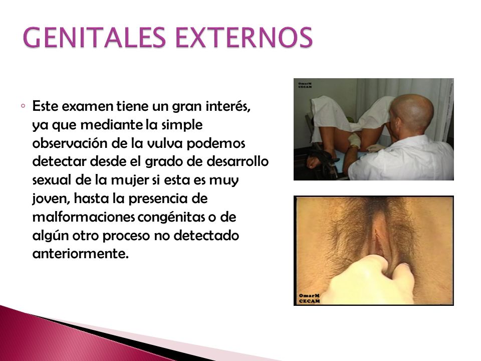 GENITALES EXTERNOS
