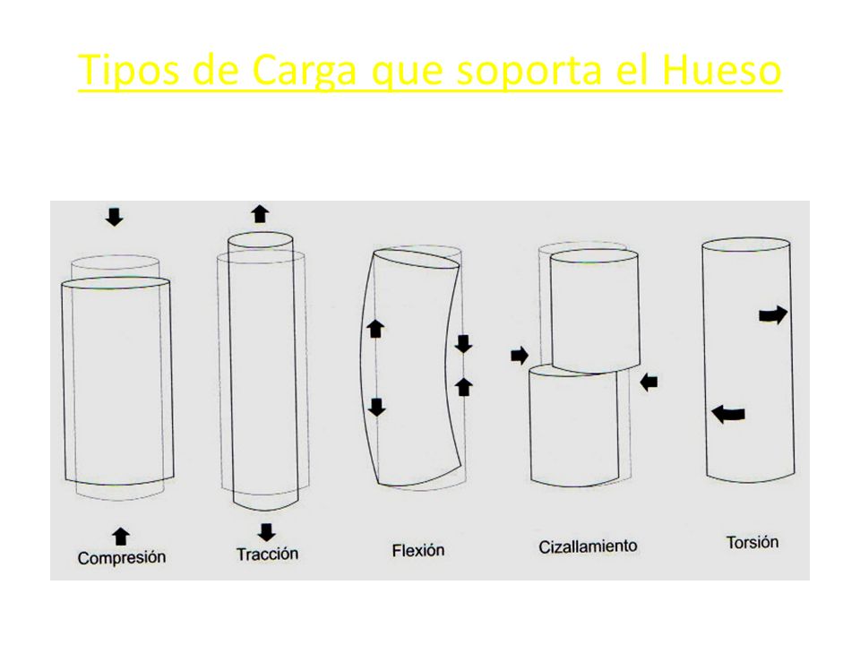Tipos de Carga que soporta el Hueso