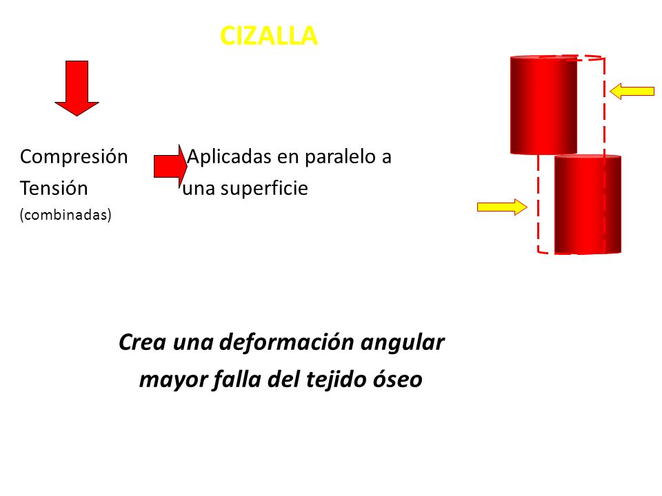 Crea una deformación angular mayor falla del tejido óseo
