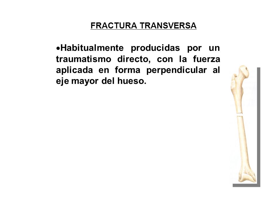 FRACTURA TRANSVERSA Habitualmente producidas por un traumatismo directo, con la fuerza aplicada en forma perpendicular al eje mayor del hueso.