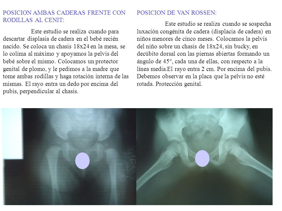 POSICION AMBAS CADERAS FRENTE CON RODILLAS AL CENIT: