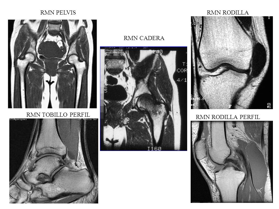 RMN PELVIS RMN RODILLA RMN CADERA RMN TOBILLO PERFIL RMN RODILLA PERFIL