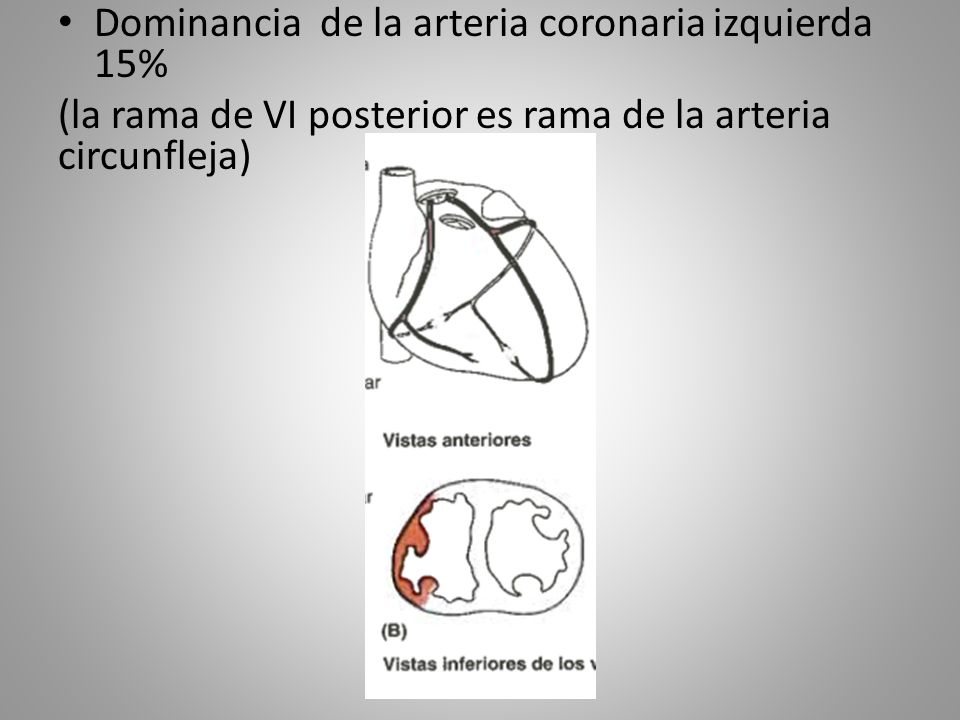 Dominancia de la arteria coronaria izquierda 15%