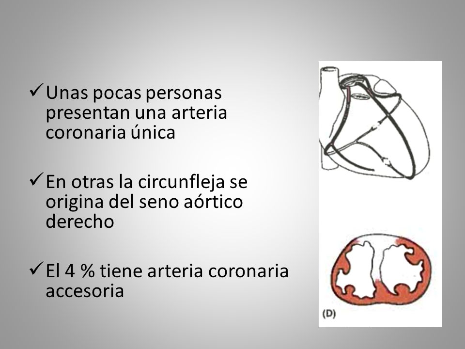 Unas pocas personas presentan una arteria coronaria única
