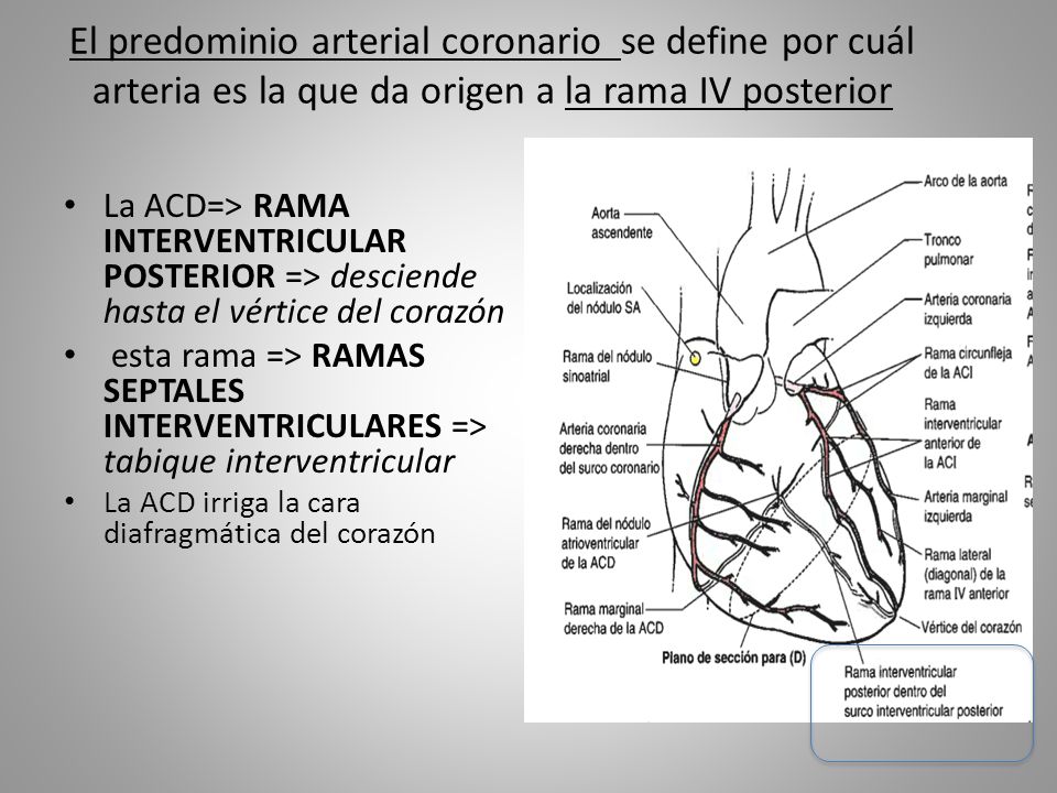 El predominio arterial coronario se define por cuál arteria es la que da origen a la rama IV posterior