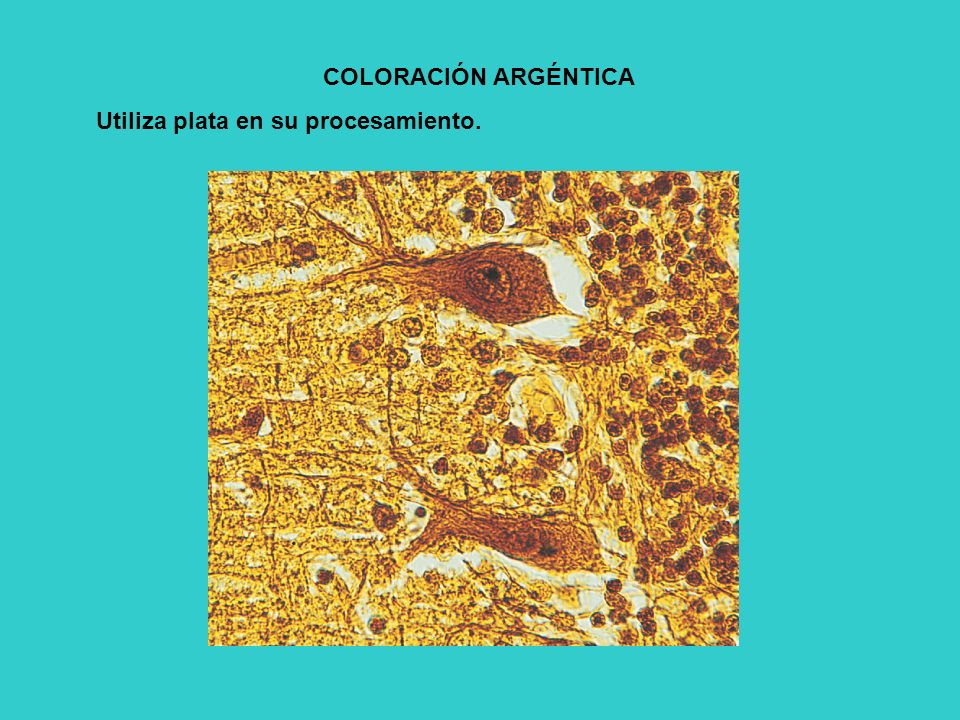 COLORACIÓN ARGÉNTICA Utiliza plata en su procesamiento.