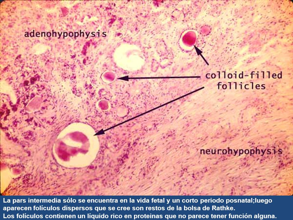 La pars intermedia sólo se encuentra en la vida fetal y un corto periodo posnatal;luego aparecen folículos dispersos que se cree son restos de la bolsa de Rathke.