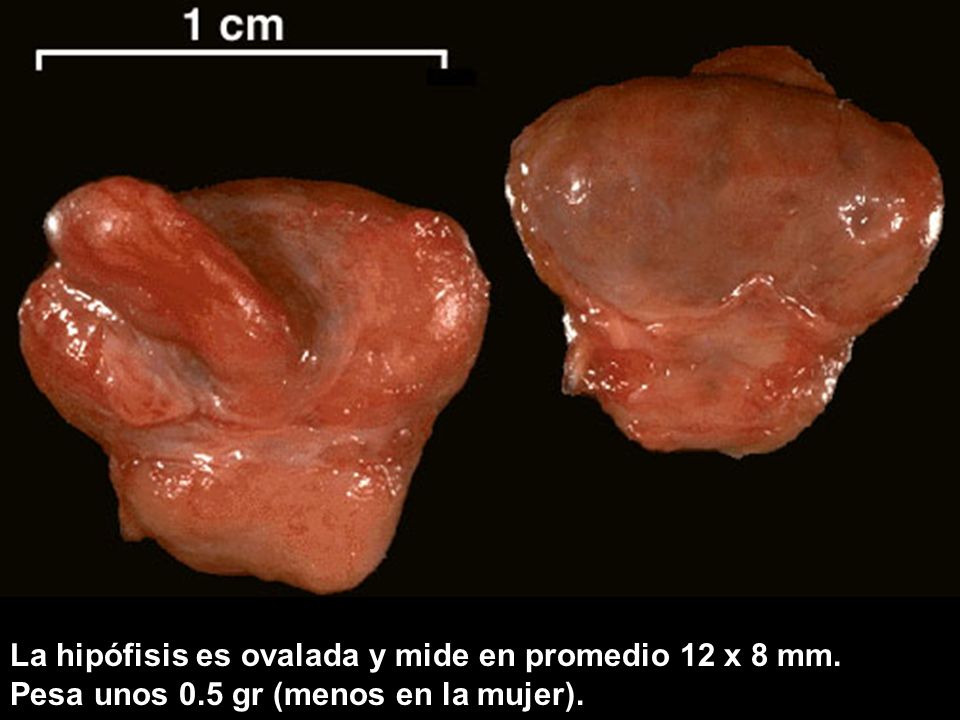 La hipófisis es ovalada y mide en promedio 12 x 8 mm.