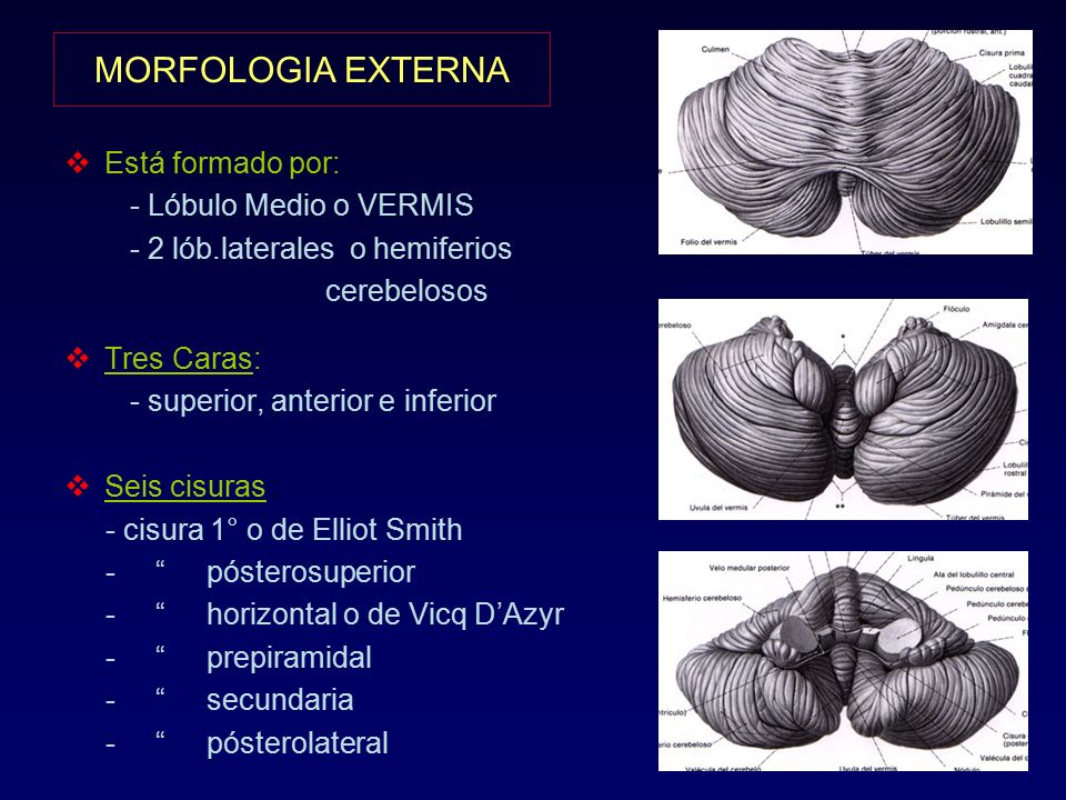 MORFOLOGIA EXTERNA Está formado por: - Lóbulo Medio o VERMIS