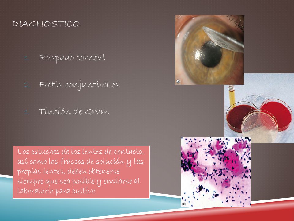 Diagnostico Raspado corneal Frotis conjuntivales Tinción de Gram