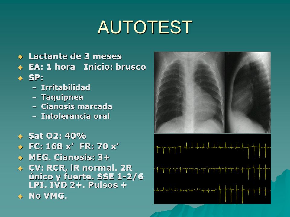 AUTOTEST Lactante de 3 meses EA: 1 hora Inicio: brusco SP: Sat O2: 40%