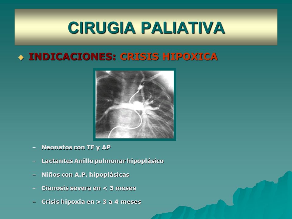 CIRUGIA PALIATIVA INDICACIONES: CRISIS HIPOXICA Neonatos con TF y AP