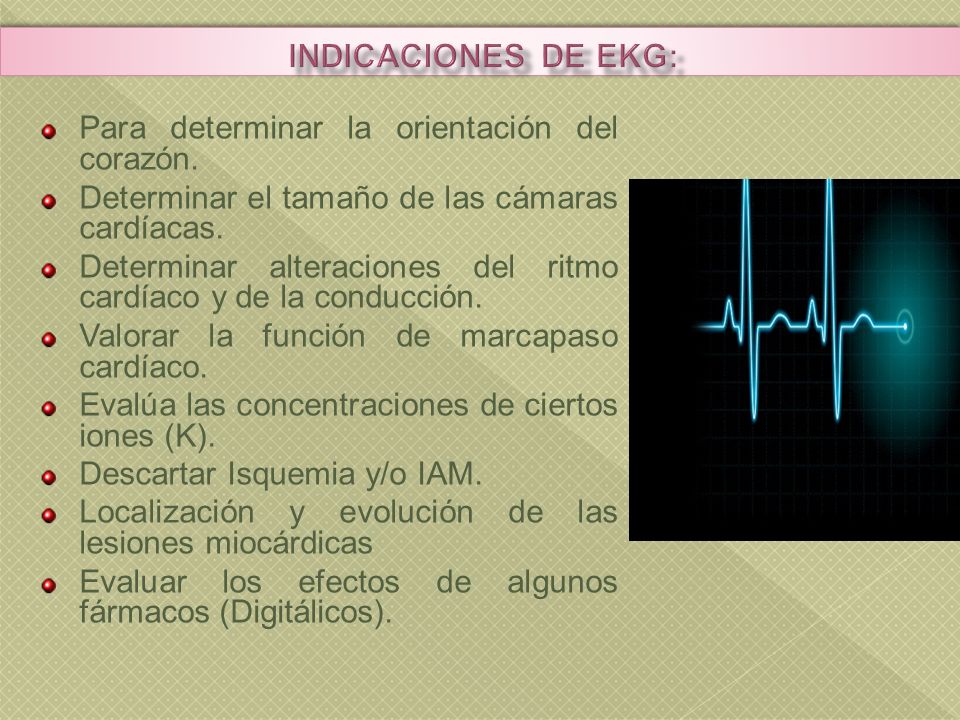 Indicaciones de ekg: Para determinar la orientación del corazón.