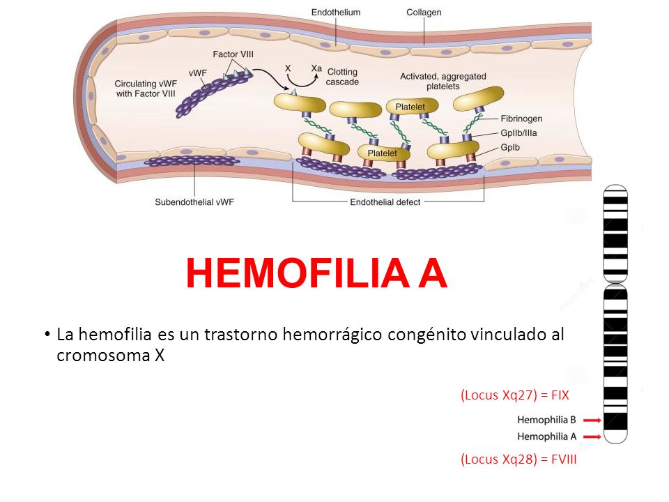 HEMOFILIA A La hemofilia es un trastorno hemorrágico congénito vinculado al cromosoma X.