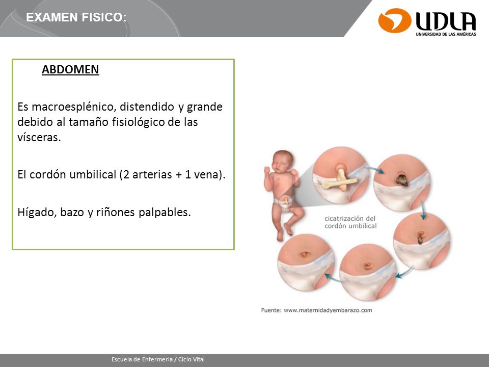El cordón umbilical (2 arterias + 1 vena).
