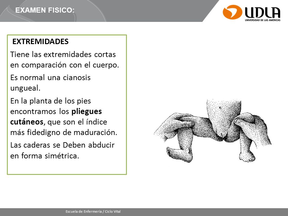 Tiene las extremidades cortas en comparación con el cuerpo.