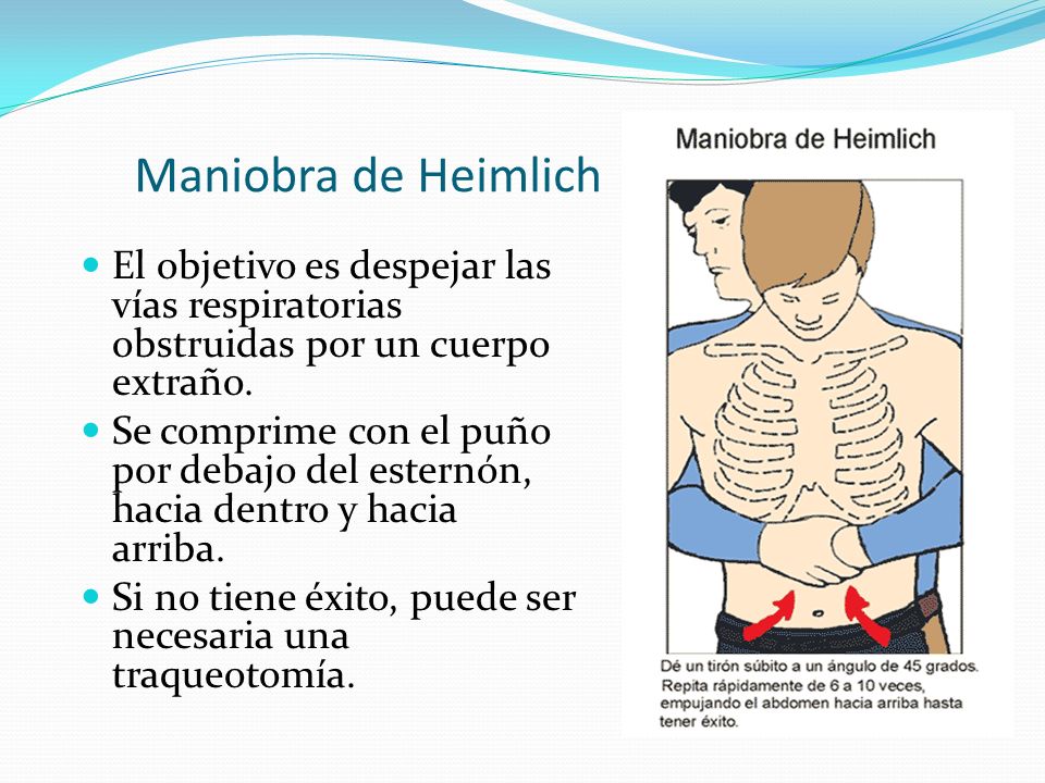 Maniobra de Heimlich El objetivo es despejar las vías respiratorias obstruidas por un cuerpo extraño.
