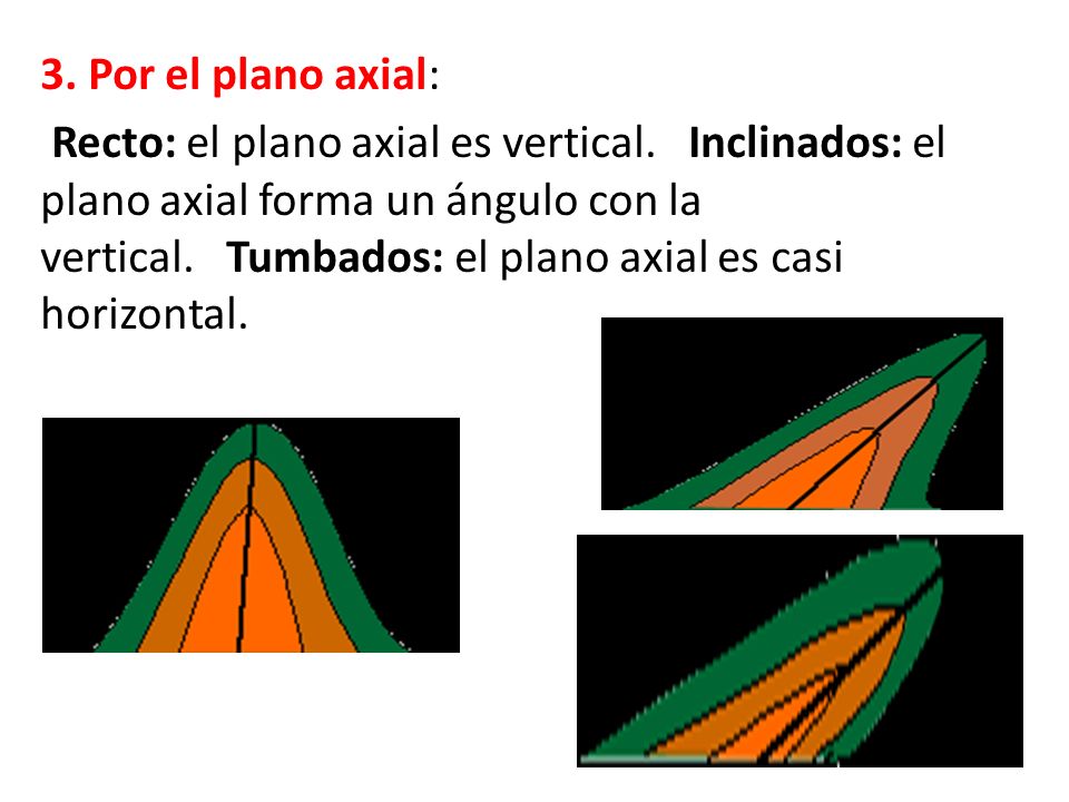 3. Por el plano axial: Recto: el plano axial es vertical