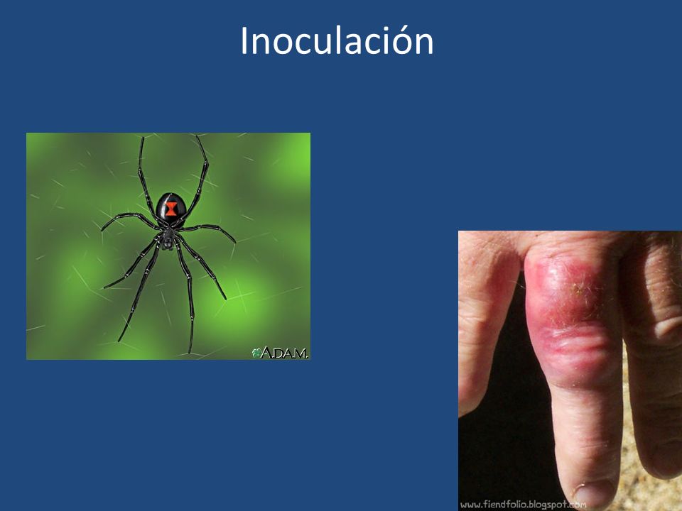 Inoculación
