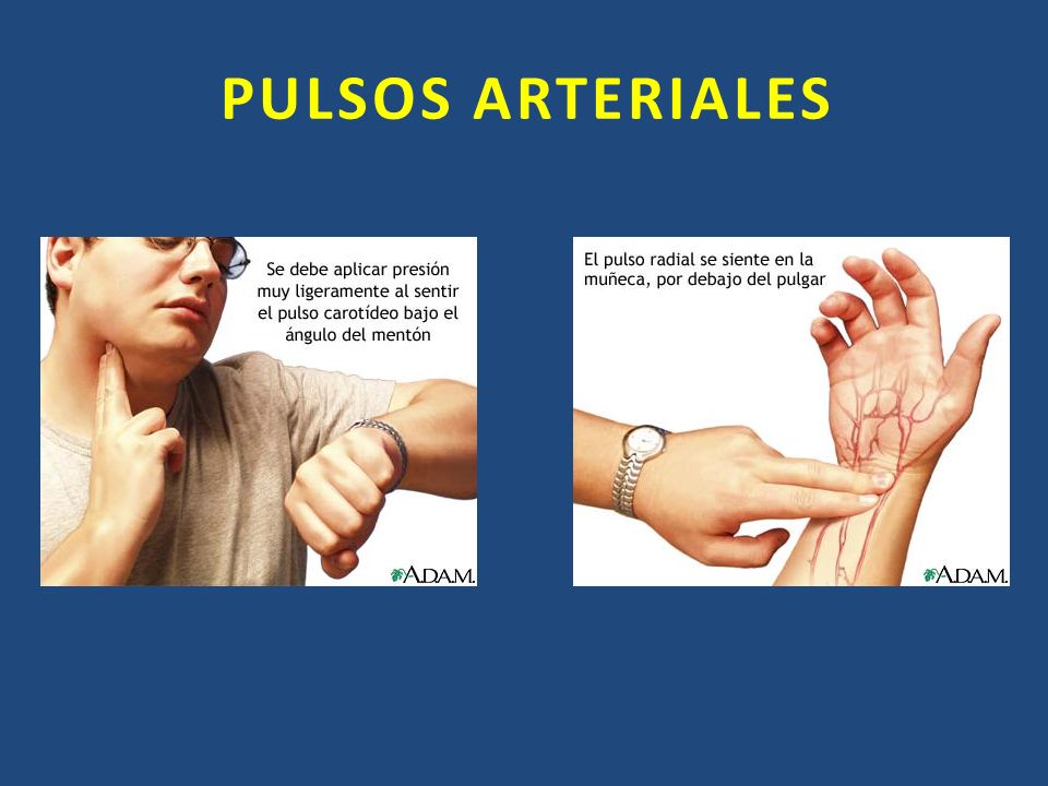 PULSOS ARTERIALES