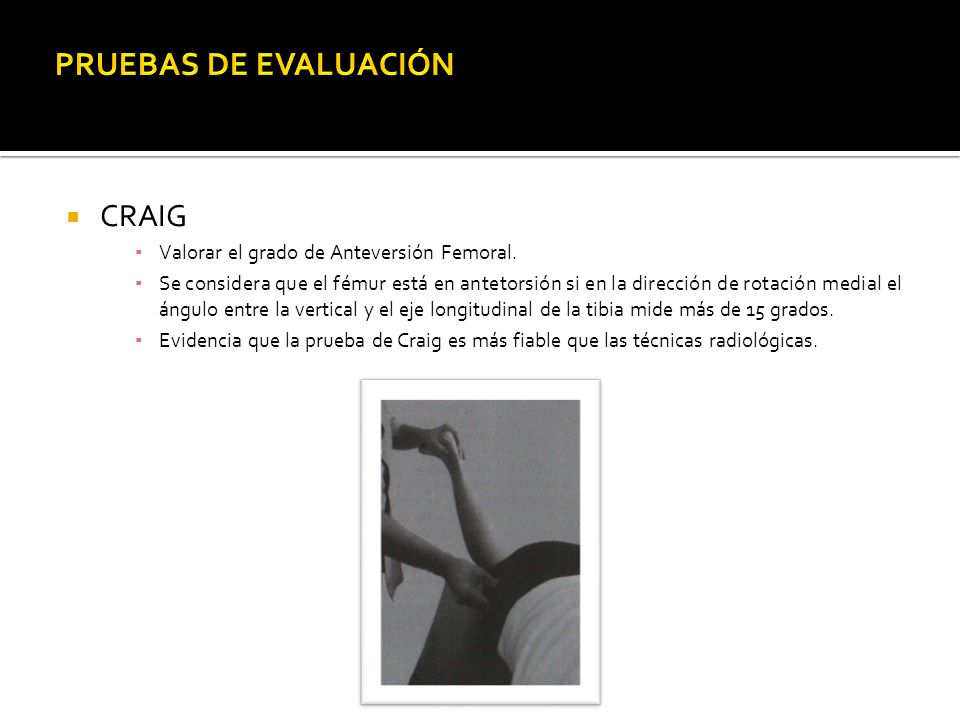 PRUEBAS DE EVALUACIÓN CRAIG Valorar el grado de Anteversión Femoral.