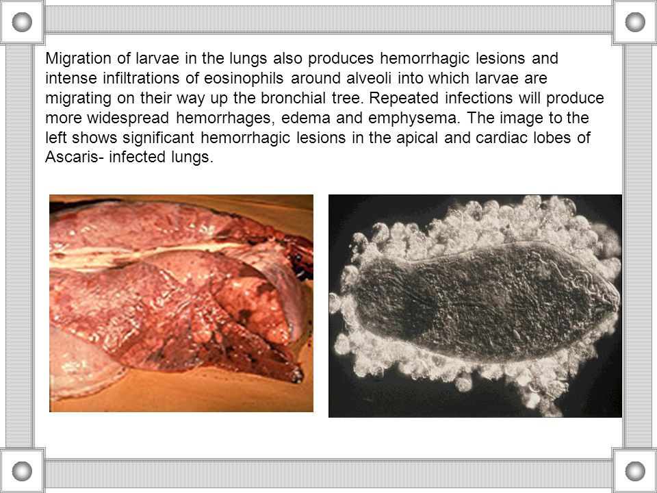 Migration of larvae in the lungs also produces hemorrhagic lesions and intense infiltrations of eosinophils around alveoli into which larvae are migrating on their way up the bronchial tree.
