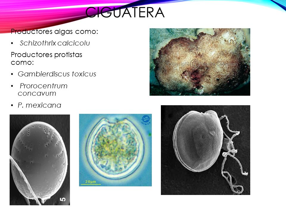 Ciguatera Productores algas como: Schizothrix calcicolu