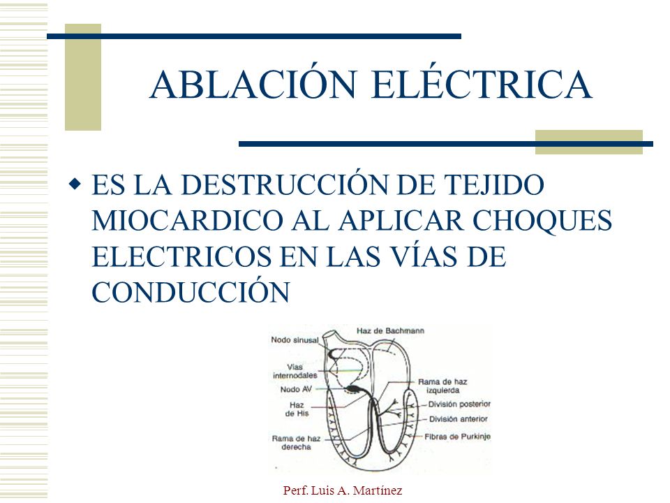 ABLACIÓN ELÉCTRICA ES LA DESTRUCCIÓN DE TEJIDO MIOCARDICO AL APLICAR CHOQUES ELECTRICOS EN LAS VÍAS DE CONDUCCIÓN.