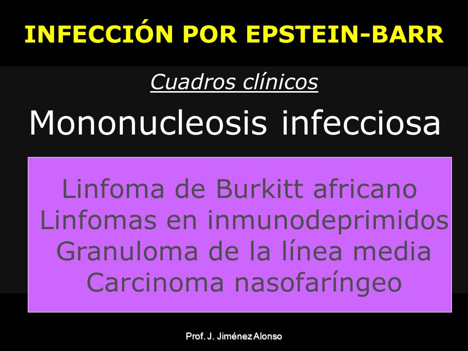 INFECCIÓN POR EPSTEIN-BARR
