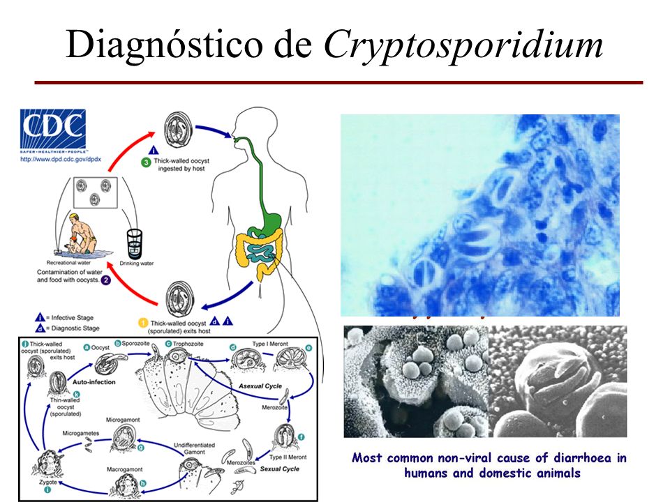 Diagnóstico de Cryptosporidium