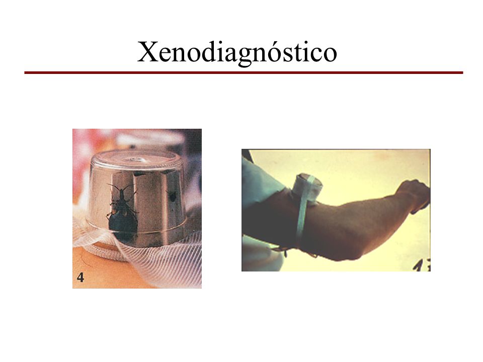 Xenodiagnóstico