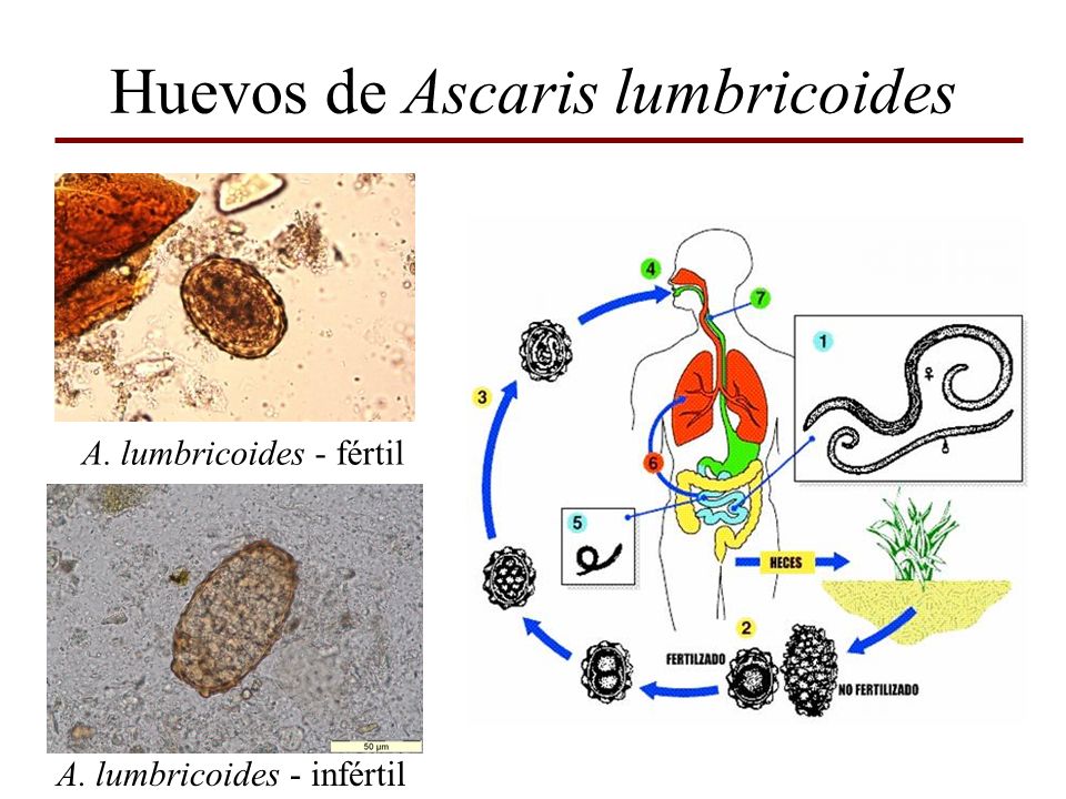 Huevos de Ascaris lumbricoides