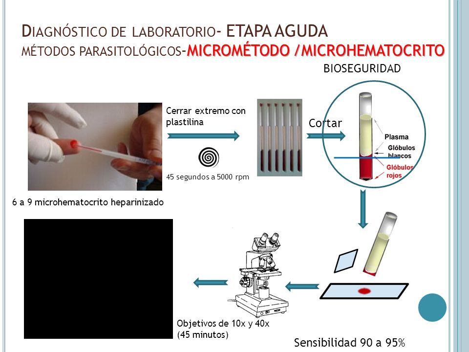 Diagnóstico de laboratorio- ETAPA AGUDA métodos parasitológicos-MICROMÉTODO /MICROHEMATOCRITO