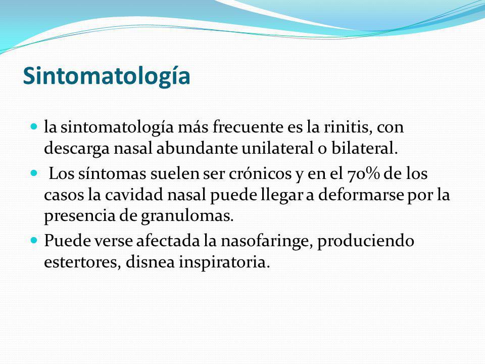 Sintomatología la sintomatología más frecuente es la rinitis, con descarga nasal abundante unilateral o bilateral.