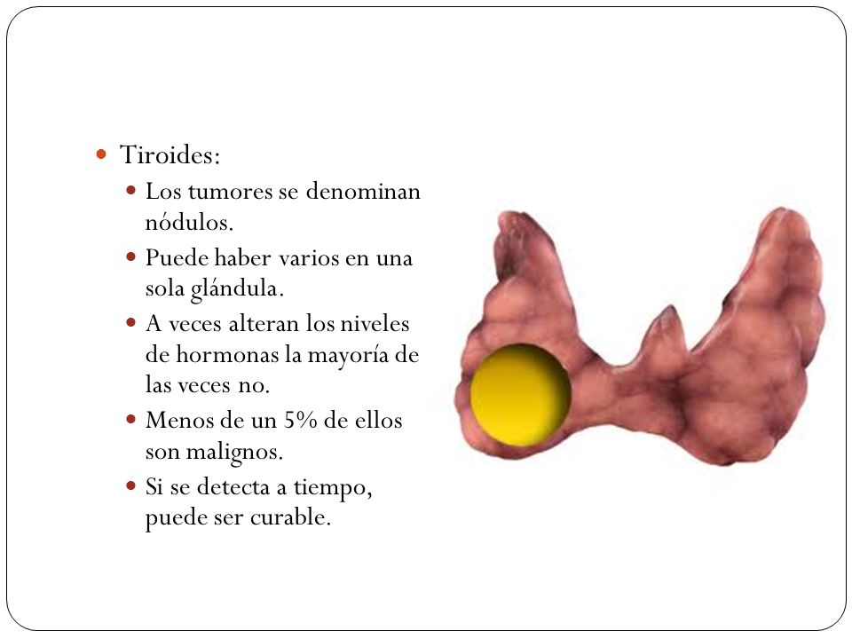 Tiroides: Los tumores se denominan nódulos.