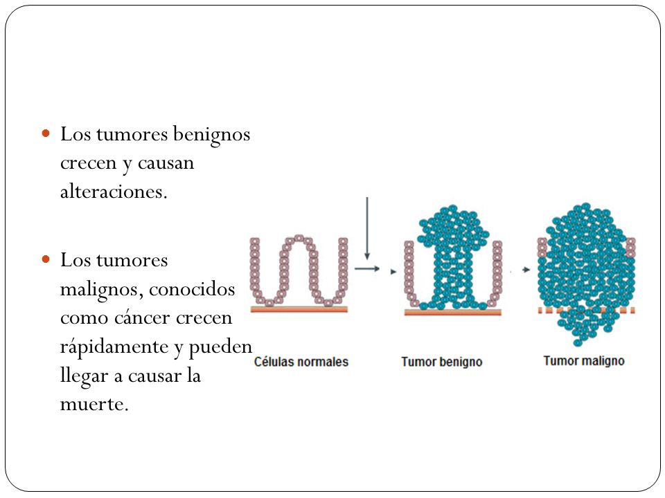 Los tumores benignos crecen y causan alteraciones.