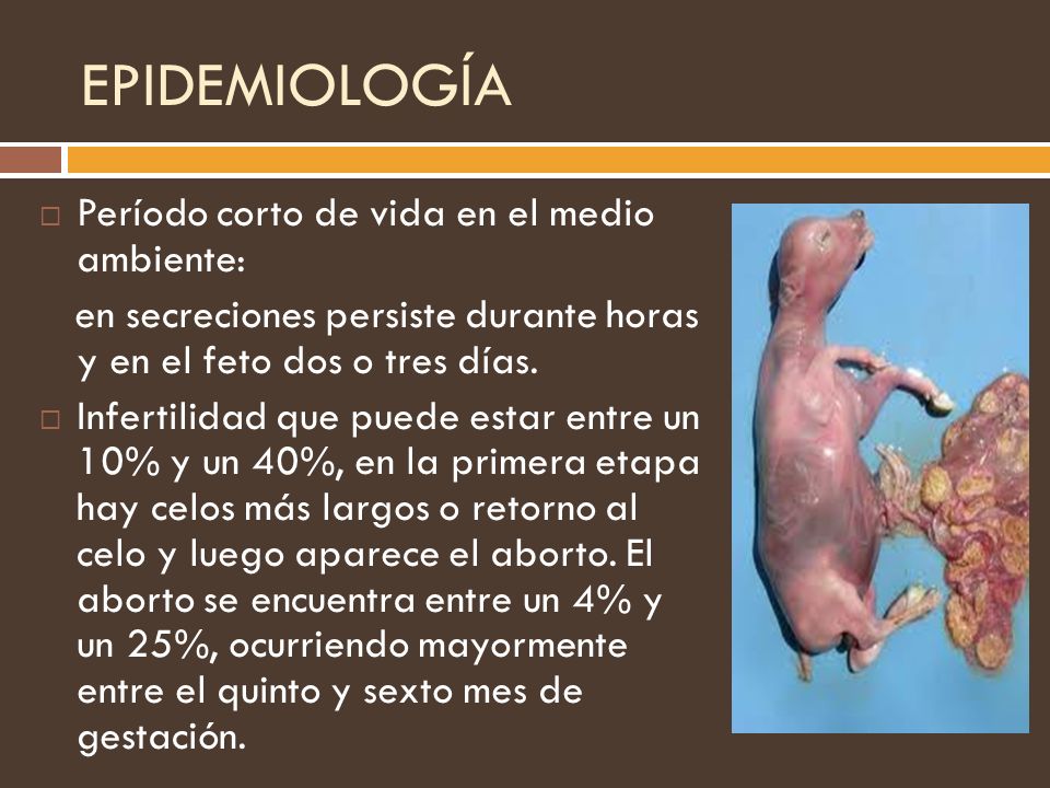 EPIDEMIOLOGÍA Período corto de vida en el medio ambiente: