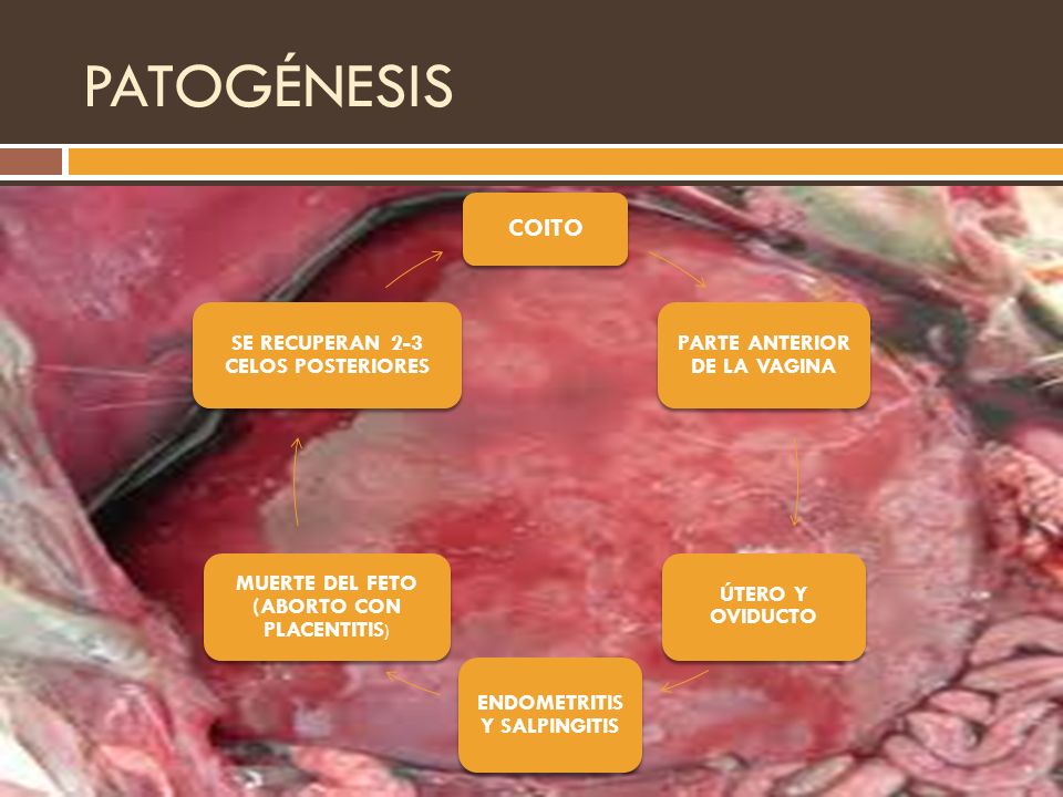 PATOGÉNESIS COITO PARTE ANTERIOR DE LA VAGINA ÚTERO Y OVIDUCTO